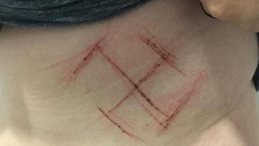 Foto da matéria “Polícia investiga caso de mulher marcada com suástica em represália a blusa contra Bolsonaro”
